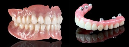 Complete removable and fixed denture