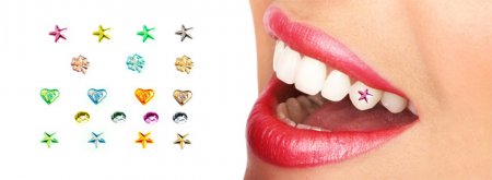 Dental jewellery