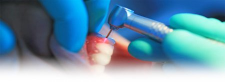 Laser treatment
